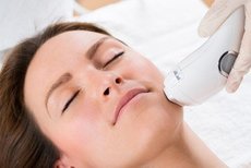 IPL fotorejuvenizácia